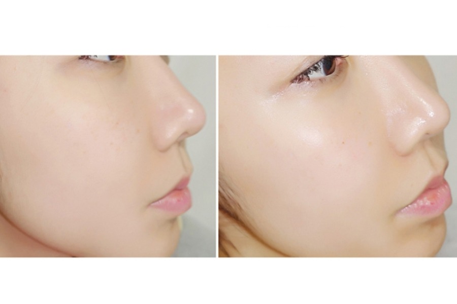 Tinh chất dưỡng trắng da chống lão hóa Buricl Hydro Luminous Perfect Essence 40ml