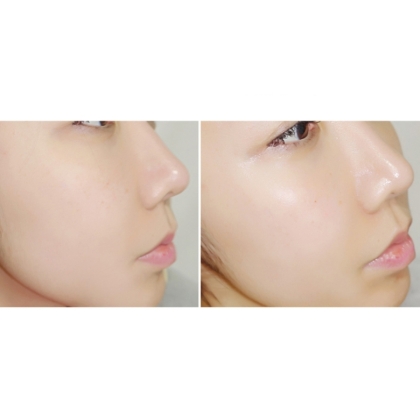 Tinh chất dưỡng trắng da chống lão hóa Buricl Hydro Luminous Perfect Essence 40ml